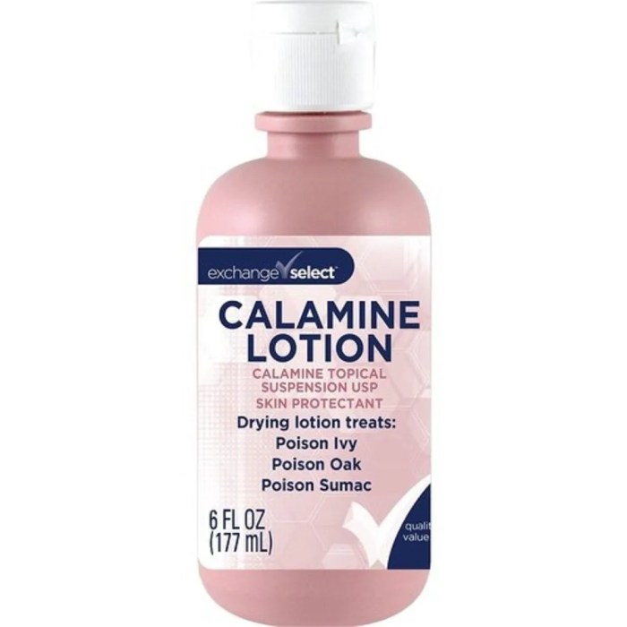 Calamine lotion for molluscum contagiosum