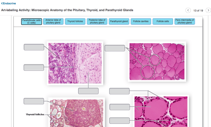 Art-labeling activity the parathyroid glands