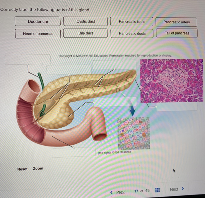 Correctly label the following histological components of this gland.